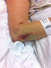 2011-05-16-Janeen's TBI-15.jpg
